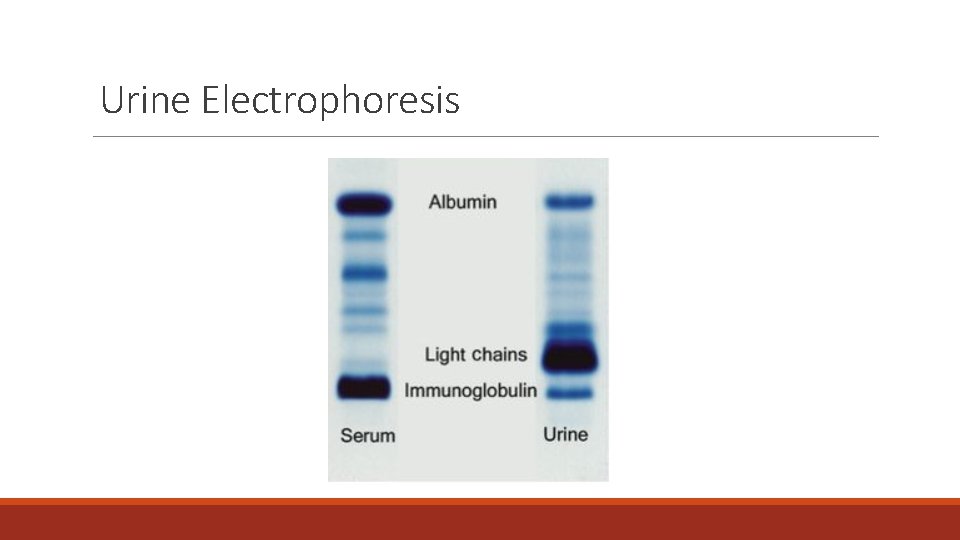 Urine Electrophoresis 