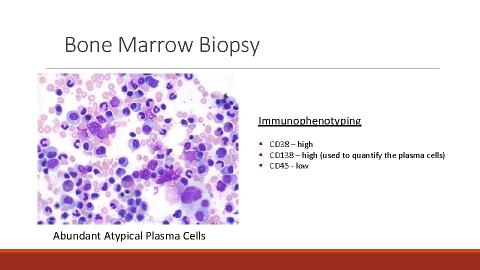 Bone Marrow Biopsy Immunophenotyping § CD 38 – high § CD 138 – high