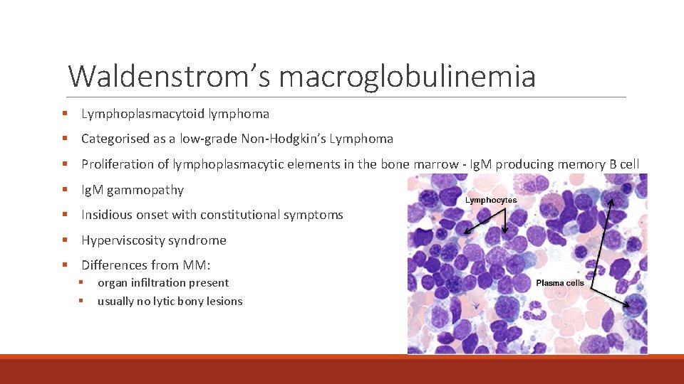 Waldenstrom’s macroglobulinemia § Lymphoplasmacytoid lymphoma § Categorised as a low-grade Non-Hodgkin’s Lymphoma § Proliferation