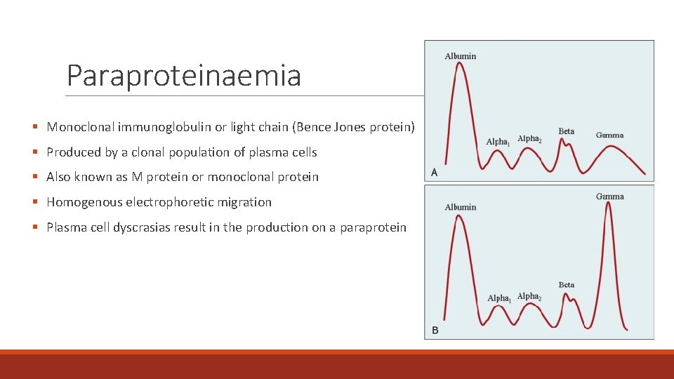 Paraproteinaemia § Monoclonal immunoglobulin or light chain (Bence Jones protein) § Produced by a