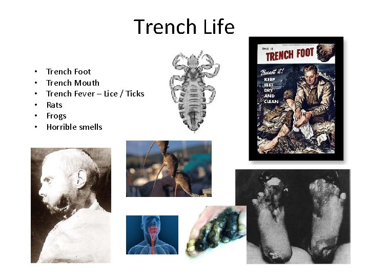 Trench Life • • • Trench Foot Trench Mouth Trench Fever – Lice /