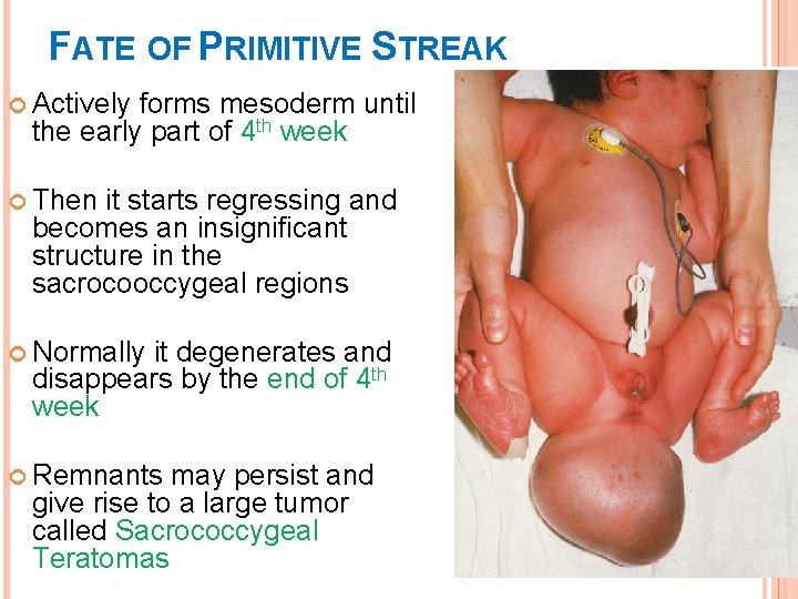 FATE OF PRIMITIVE STREAK Actively forms mesoderm until the early part of 4 th