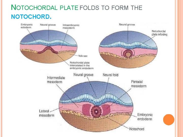 NOTOCHORDAL PLATE FOLDS TO FORM THE NOTOCHORD. 