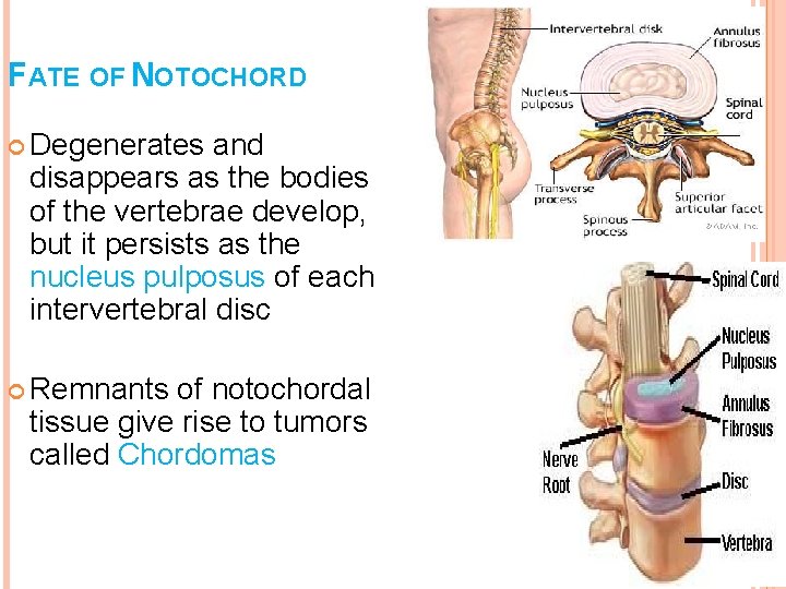 FATE OF NOTOCHORD Degenerates and disappears as the bodies of the vertebrae develop, but