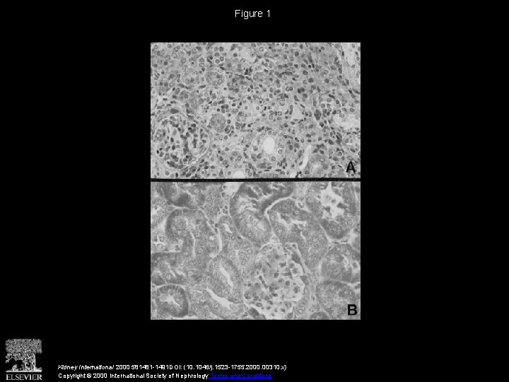 Figure 1 Kidney International 2000 581481 -1491 DOI: (10. 1046/j. 1523 -1755. 2000. 00310.