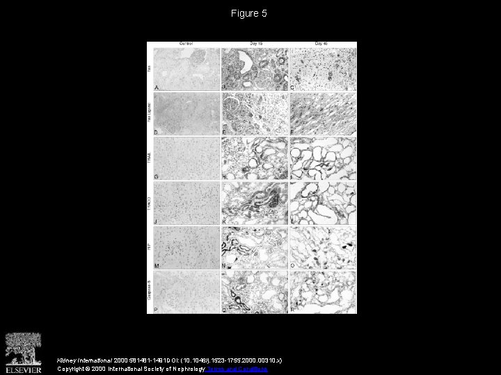 Figure 5 Kidney International 2000 581481 -1491 DOI: (10. 1046/j. 1523 -1755. 2000. 00310.