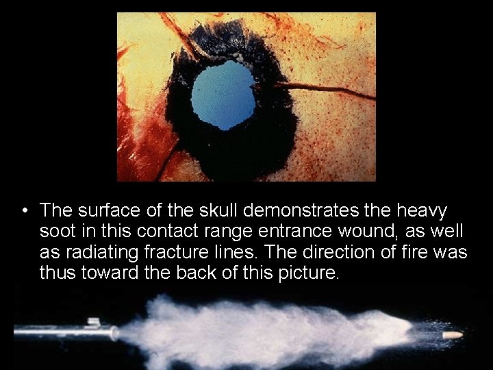  • The surface of the skull demonstrates the heavy soot in this contact