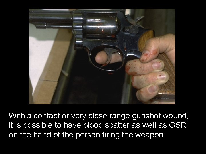 With a contact or very close range gunshot wound, it is possible to have
