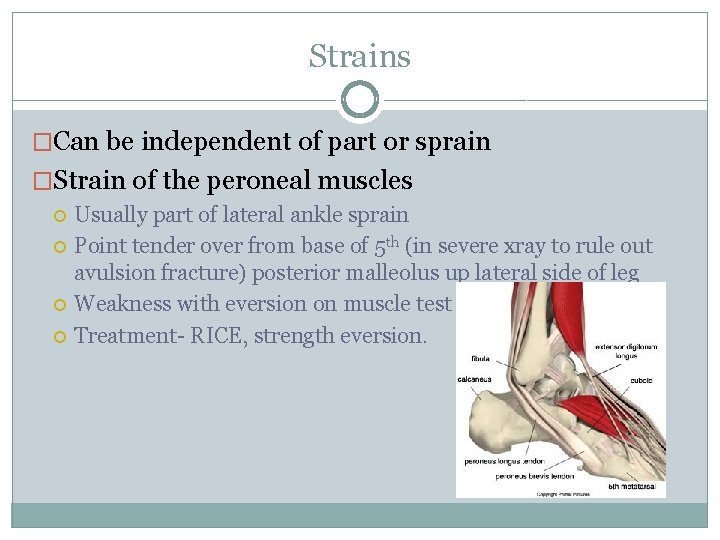 Strains �Can be independent of part or sprain �Strain of the peroneal muscles Usually