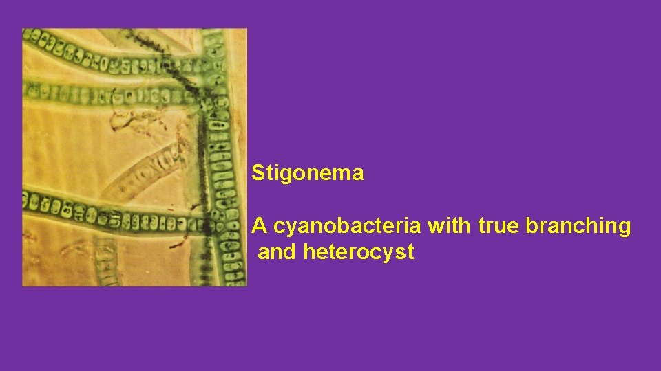 Stigonema A cyanobacteria with true branching and heterocyst 