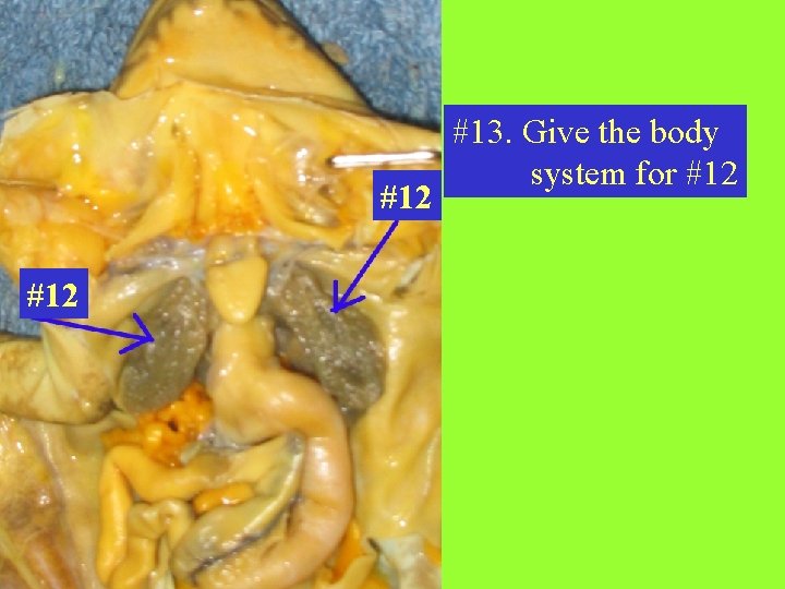 #12 #13. Give the body system for #12 