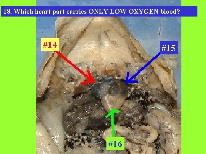 18. Which heart part carries ONLY LOW OXYGEN blood? #14 #15 #16 