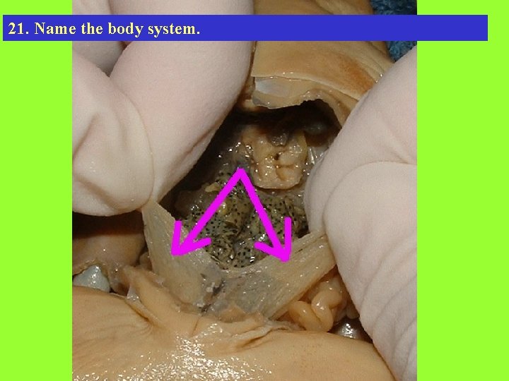 21. Name the body system. 