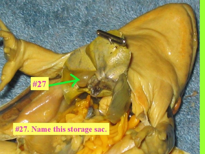 #27 #27. Name this storage sac. 