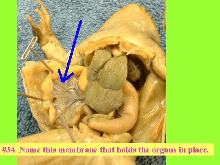 #34. Name this membrane that holds the organs in place. 