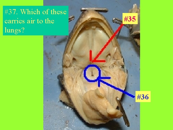 #37. Which of these carries air to the lungs? #35 #36 