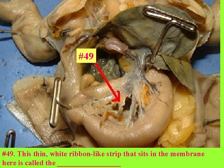#49 #49. This thin, white ribbon-like strip that sits in the membrane here is