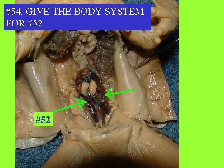 #54. GIVE THE BODY SYSTEM FOR #52 