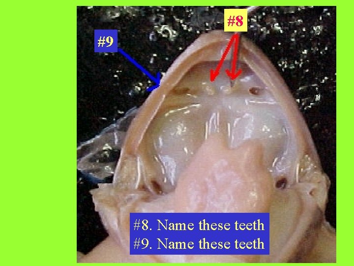#8 #9 #8. Name these teeth #9. Name these teeth 