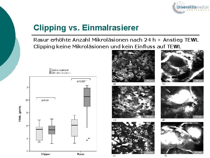 Clipping vs. Einmalrasierer Rasur erhöhte Anzahl Mikroläsionen nach 24 h + Anstieg TEWL Clipping