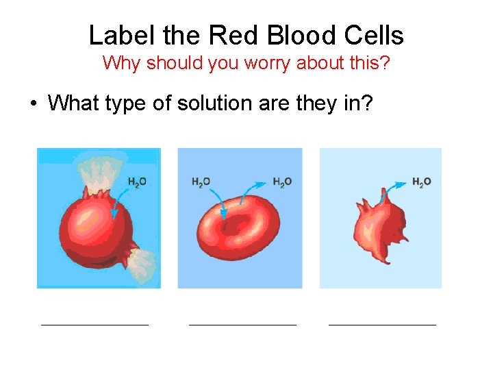 Label the Red Blood Cells Why should you worry about this? • What type