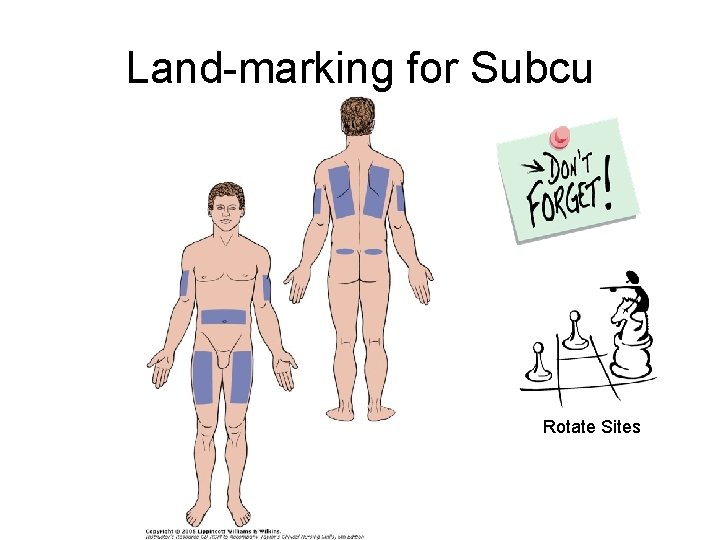 Land-marking for Subcu Rotate Sites 