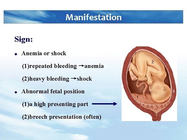 Manifestation Sign: u Anemia or shock (1)repeated bleeding →anemia (2)heavy bleeding →shock u Abnormal