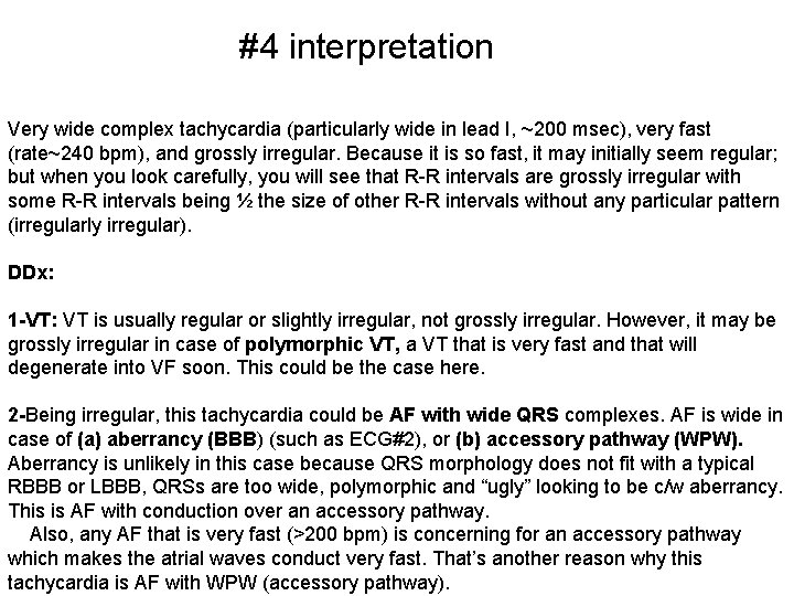 #4 interpretation Very wide complex tachycardia (particularly wide in lead I, ~200 msec), very
