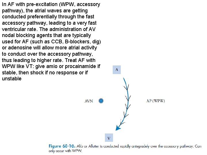 In AF with pre-excitation (WPW, accessory pathway), the atrial waves are getting conducted preferentially