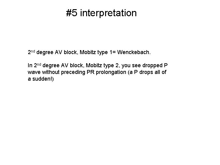 #5 interpretation 2 nd degree AV block, Mobitz type 1= Wenckebach. In 2 nd