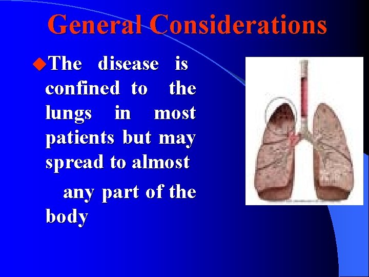 General Considerations u. The disease is confined to the lungs in most patients but