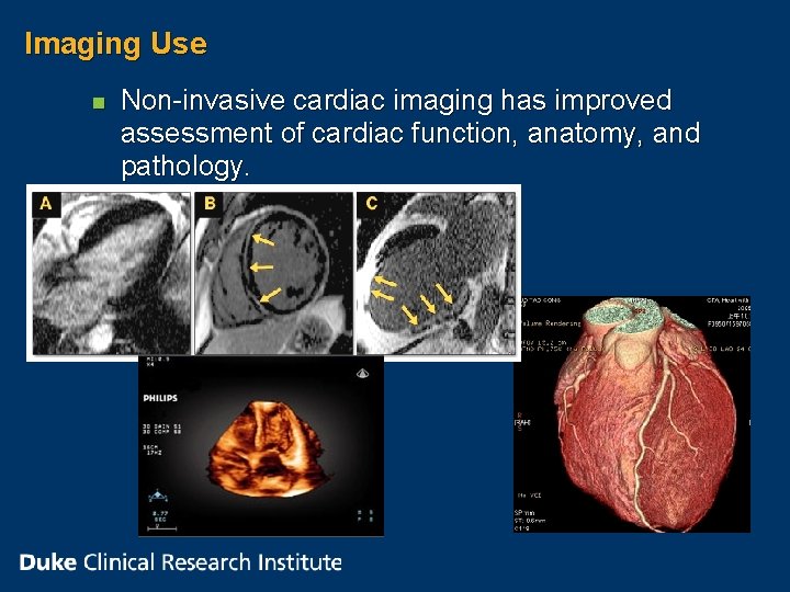 Imaging Use n Non-invasive cardiac imaging has improved assessment of cardiac function, anatomy, and