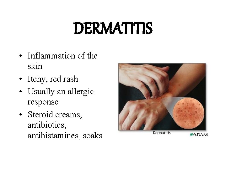 DERMATITIS • Inflammation of the skin • Itchy, red rash • Usually an allergic
