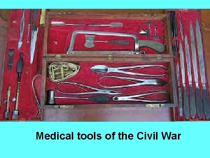 Medical tools of the Civil War 