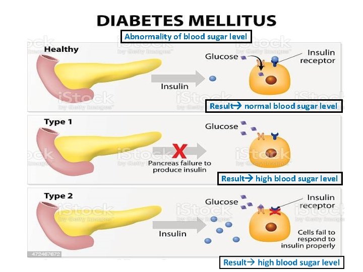 Abnormality of blood sugar level Result normal blood sugar level Result high blood sugar