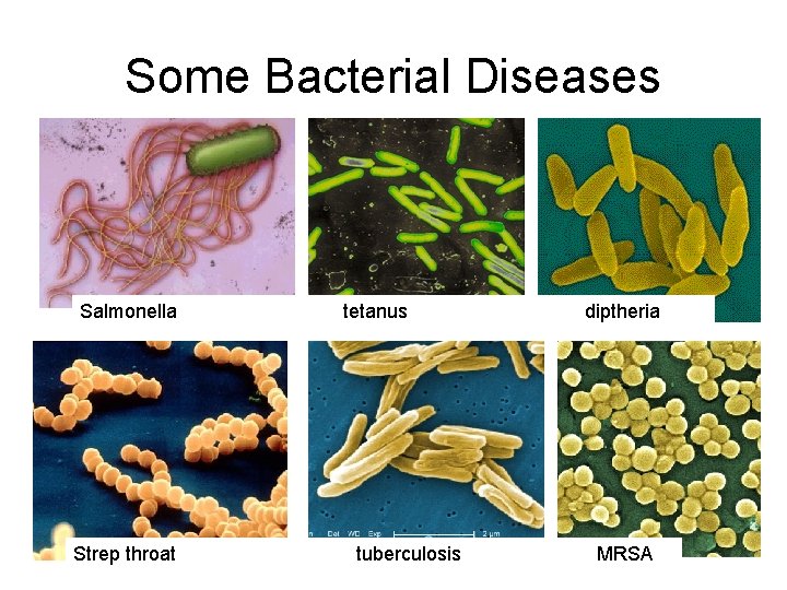 Some Bacterial Diseases Salmonella Strep throat tetanus tuberculosis diptheria MRSA 