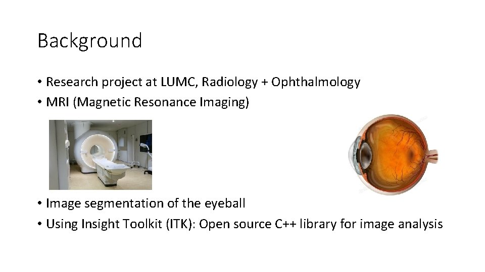 Background • Research project at LUMC, Radiology + Ophthalmology • MRI (Magnetic Resonance Imaging)