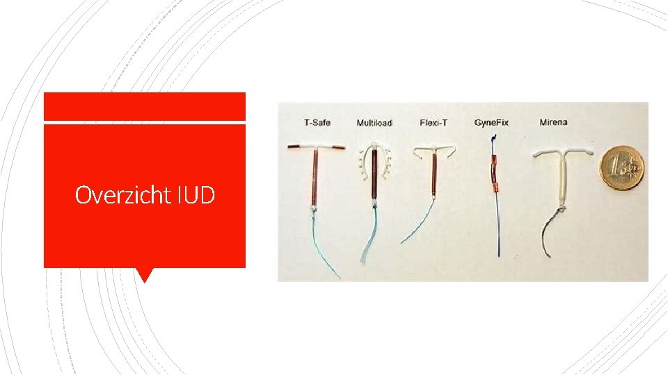 Overzicht IUD 