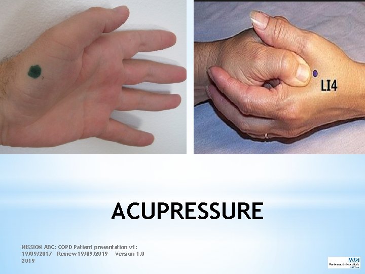 ACUPRESSURE MISSION ABC: COPD Patient presentation v 1: 19/09/2017 Review 19/09/2019 Version 1. 0