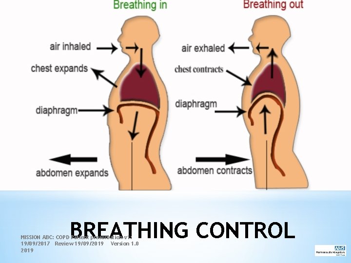 BREATHING CONTROL MISSION ABC: COPD Patient presentation v 1: 19/09/2017 Review 19/09/2019 Version 1.