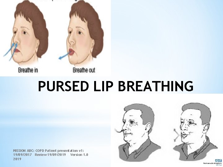 PURSED LIP BREATHING MISSION ABC: COPD Patient presentation v 1: 19/09/2017 Review 19/09/2019 Version