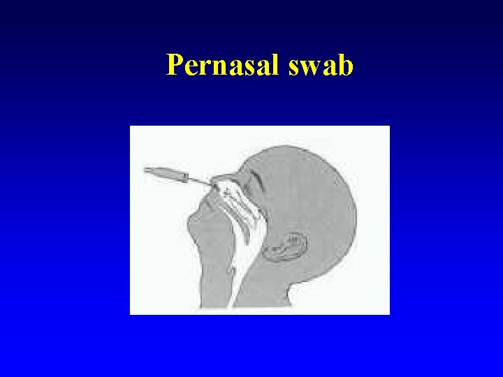 Pernasal swab 
