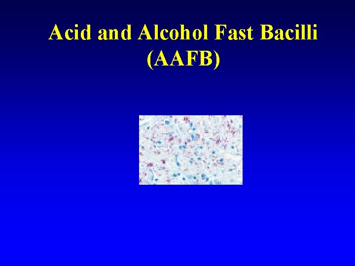 Acid and Alcohol Fast Bacilli (AAFB) 