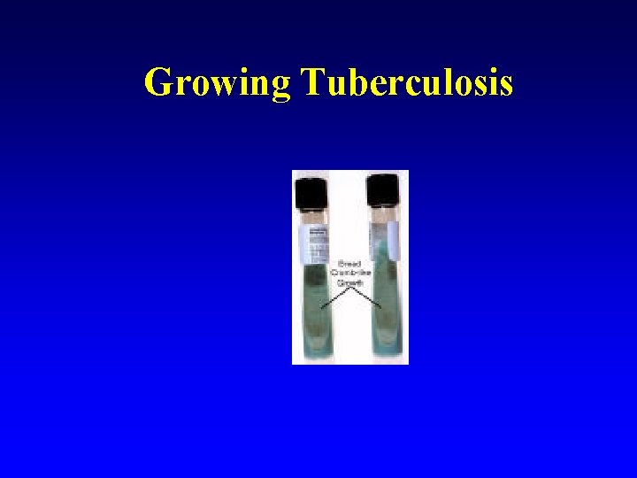 Growing Tuberculosis 