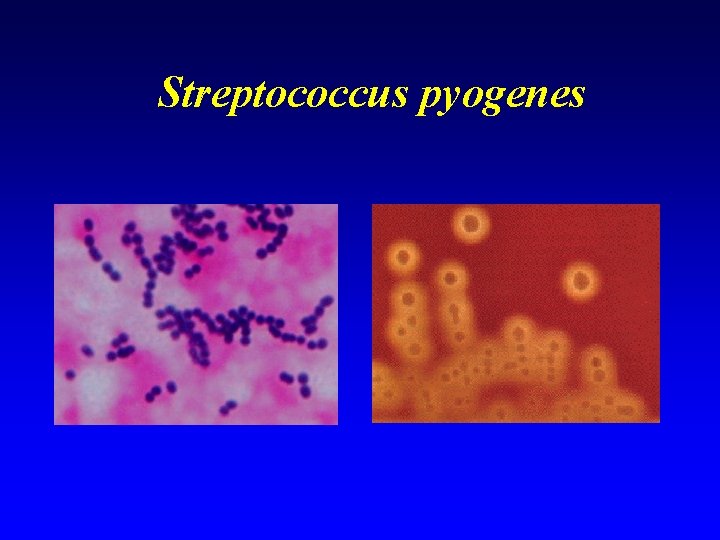 Streptococcus pyogenes 