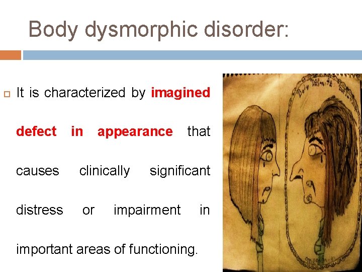 Body dysmorphic disorder: It is characterized by imagined defect in appearance causes clinically distress