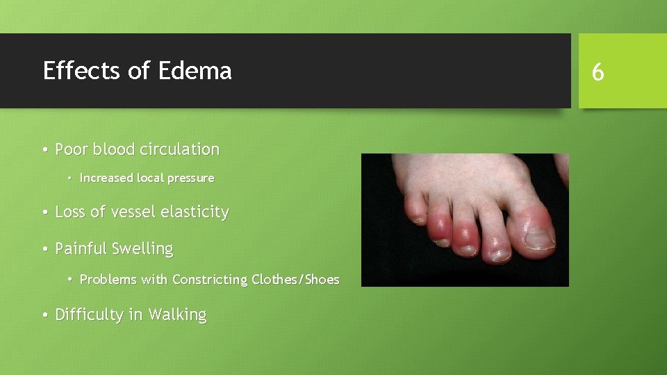 Effects of Edema • Poor blood circulation • Increased local pressure • Loss of