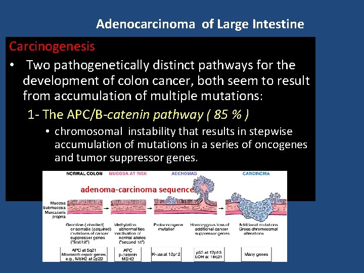 Adenocarcinoma of Large Intestine Carcinogenesis • Two pathogenetically distinct pathways for the development of