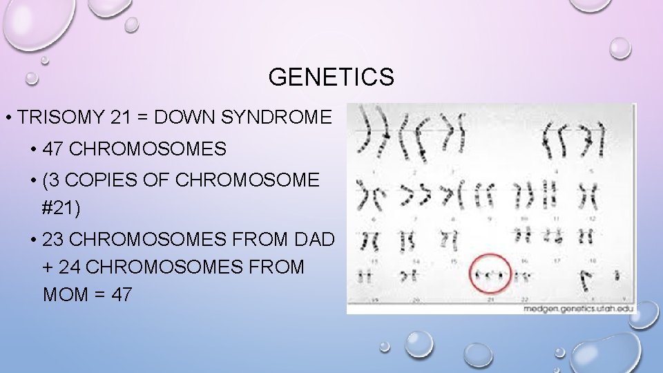 GENETICS • TRISOMY 21 = DOWN SYNDROME • 47 CHROMOSOMES • (3 COPIES OF