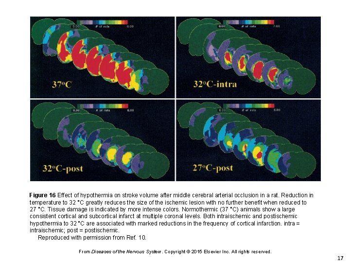 Figure 16 Effect of hypothermia on stroke volume after middle cerebral arterial occlusion in